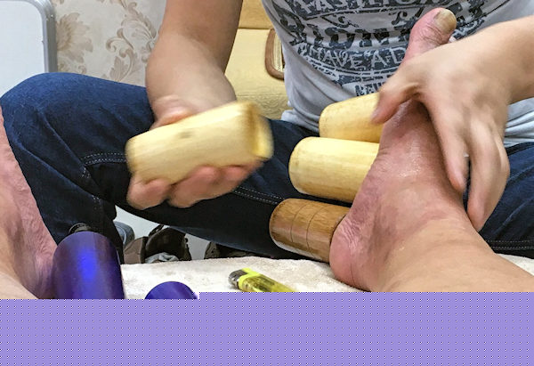 足裏もカッピング（深圳・蛇口）